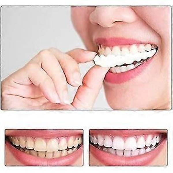 Smile Lösa Tänder, Temporära Ersättningsfanér-kit för att Täcka Imperfekta Tänder