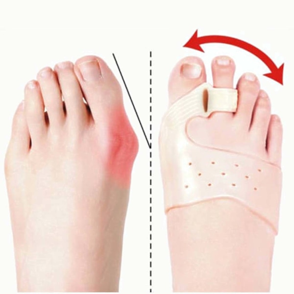 2 Pack Hallux Valgus Toe Separator Gel beige