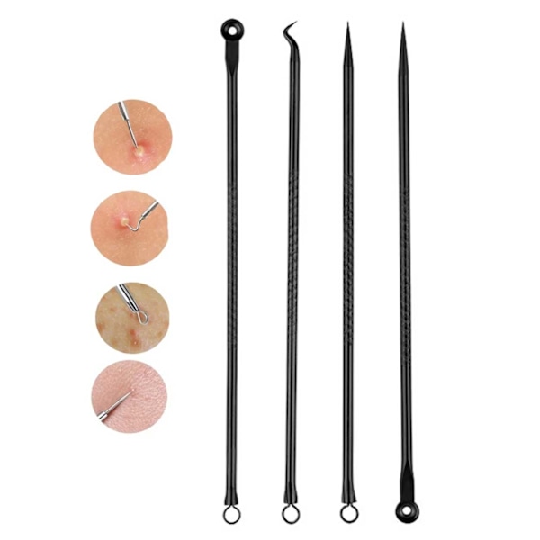 4 -pakk Blackwood klemmer - Fjerner lett svarthoder svart svart
