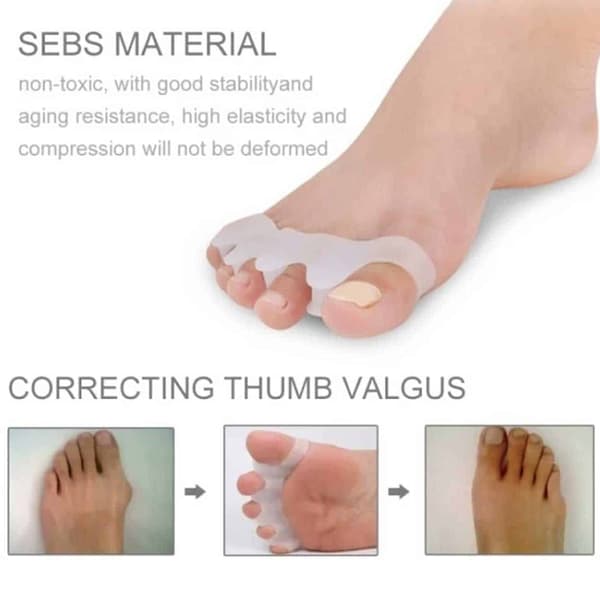 Hallux Valgus Toe -levittimet - erottaa varpaat - tuki beige