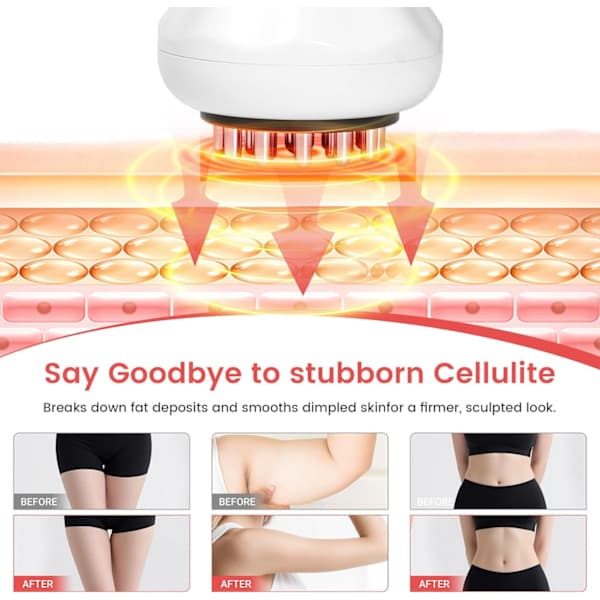 Lymfdränagemassageapparat – Djupmassage för kropp & celluliter vit