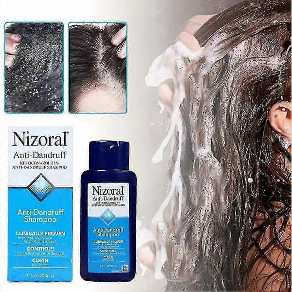 Nizoral skælshampoo med frisk duft 200 ml EXP 2025