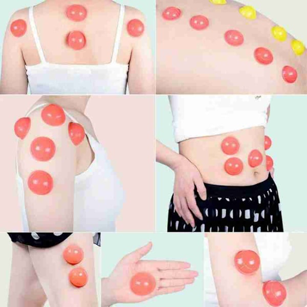 12-pack Silikonkoppningsset Akupunktur Koppningsterapi Set Professionell Kroppsmassage Vakuumkoppningsset