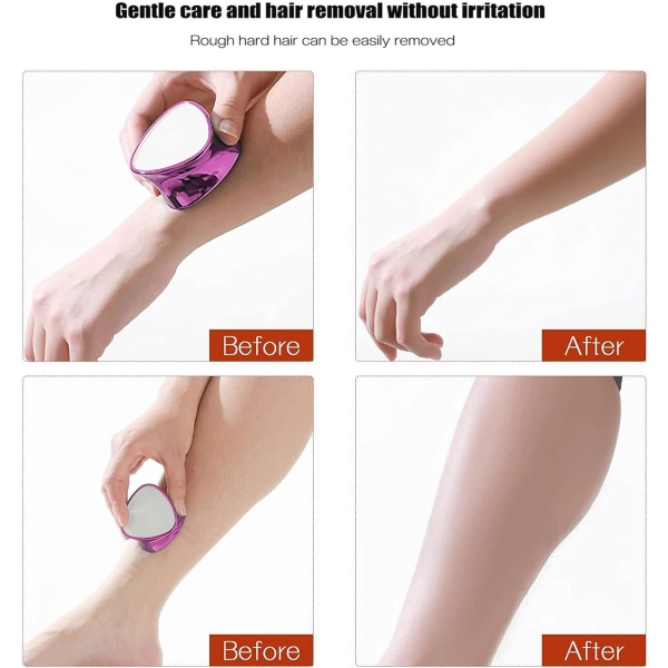 1 sæt (lilla) Krystal Epilator, Nano Hårfjernelsesviskelæder, Krystal