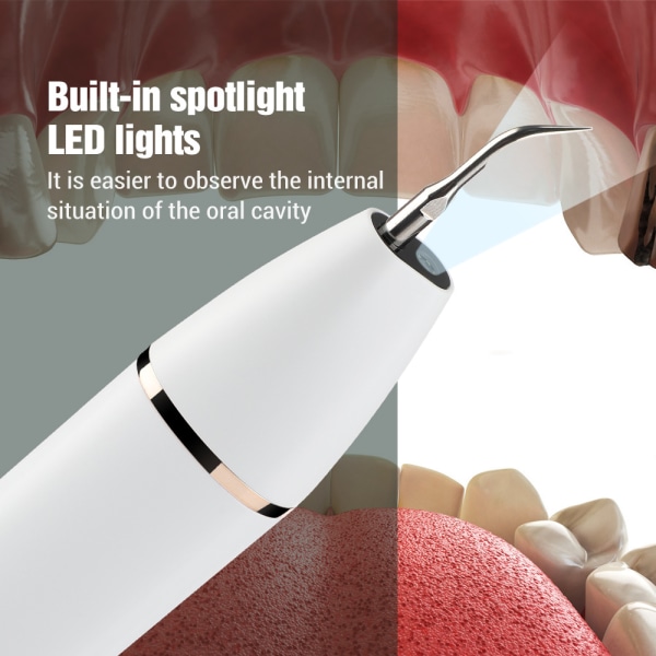 1 dental scaler WiFi visuell 4-växlad LED-ljus intelligent
