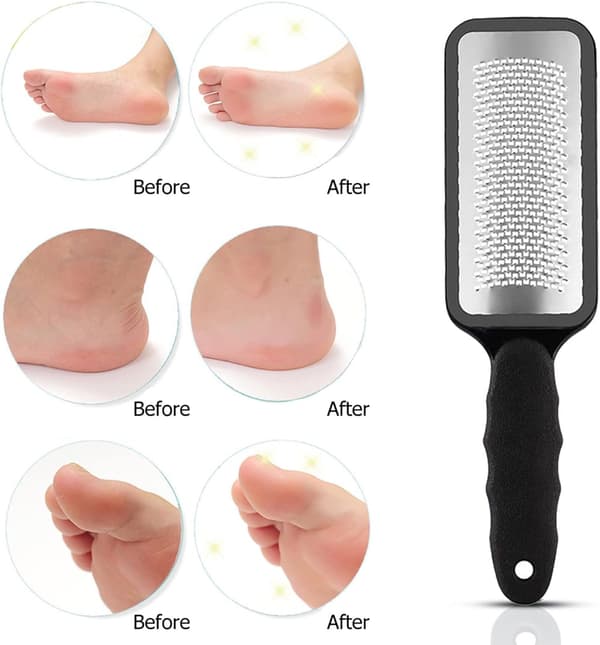 Fodhårdhudsfjerner, Fod Død Hudfjerner, Fod Manicure