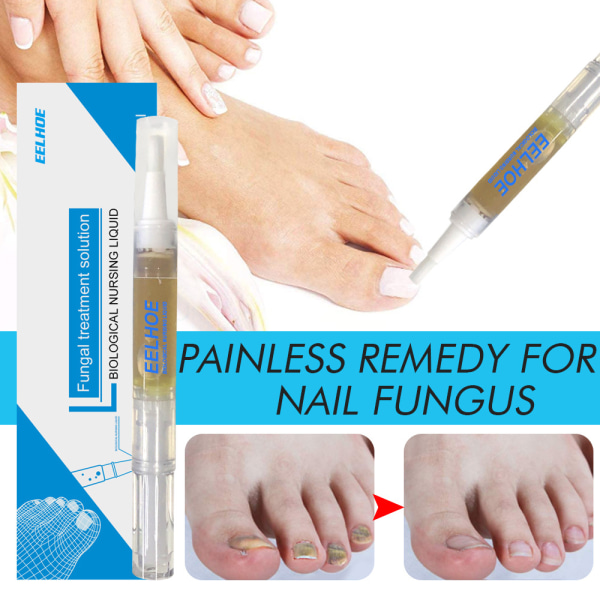 2st Nagelreparationslösning Hand- och fotgrå nagelvårdsreparation