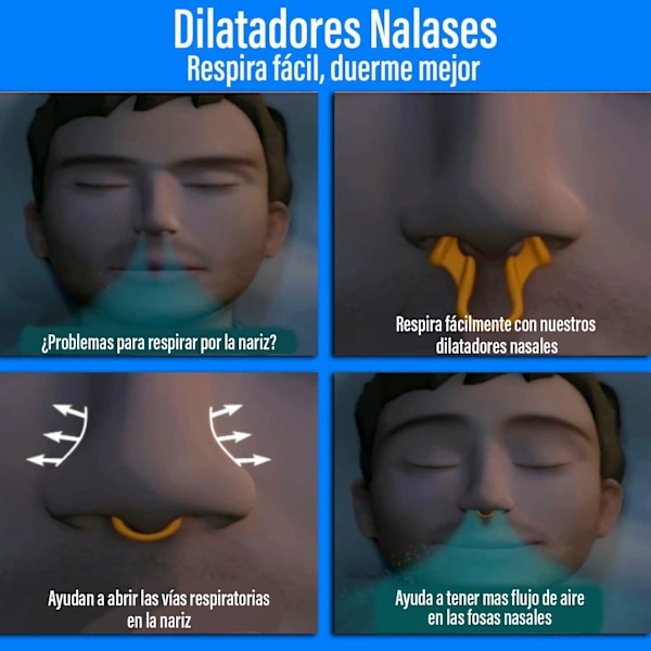 Silikon Næse Dilatorer (4) - Næse dilator, ånd bedre, sov bedre, snork mindre. Hjælper med at reducere snorken. Åbn din næse for at ånde bedre. Meget behagelig. Inkluderer etui