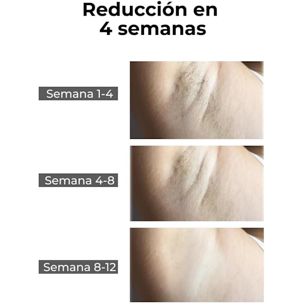 IPL Laser Epilator, Epilator til ansigt, armhuler, krop og bikini.