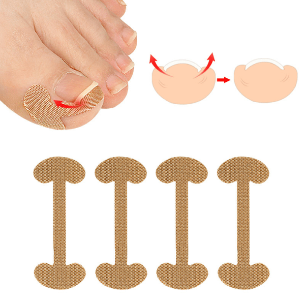 Nail Correction Stickers 100stk Nail Treatment Recover inngrodd