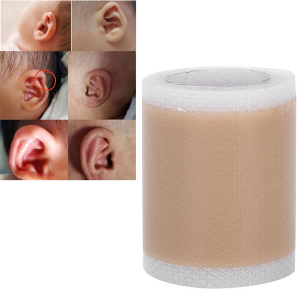 Silikone Børne Spædbarn Udragende Øre Patch Stickers Nyfødte Baby Øre Æstetiske Korrekturer 4 x 100cm / 1.6 x 39.4in