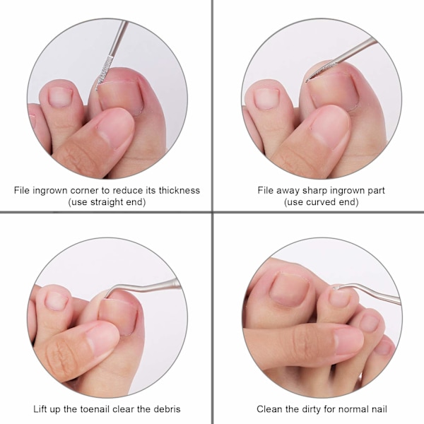 Set med fil och lyftare för inåtväxande naglar, professionella pedikyrverktyg med ergonomisk design i kirurgiskt rostfritt stål för enkel och säker behandling av tånaglar