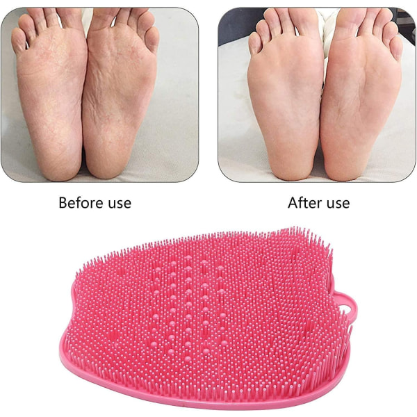 Foot Massager Apple Shape - Fotborste med halkfria silikonsugkoppar, skrubbar lätt, förbättrar fotcirkulationen, exfolierar död hud (rosa)