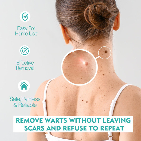 Skin Tags Remover Smärtfri hud mörk fläck - Perfet