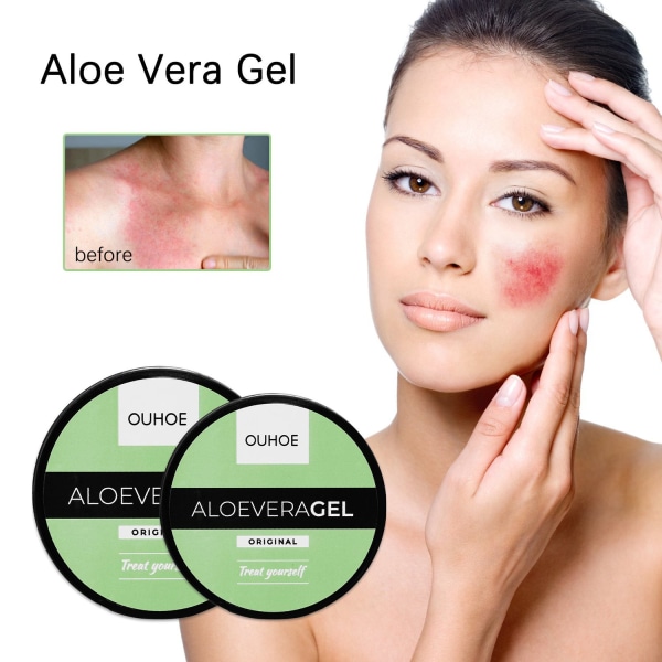 OUHOE Aloe Vera Sunburn Gel - Skin Repair Gel - Perfet #1 50g