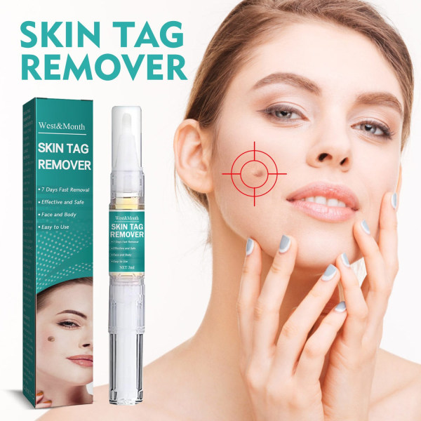 Skin Tags Remover Kivuton iho Tumma Spot - Perfet