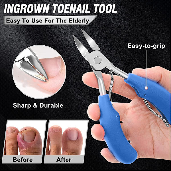 Negleklipper til tykke og indgroede tånegle - skarpt buet blad - Perfet Blue 4-piece set