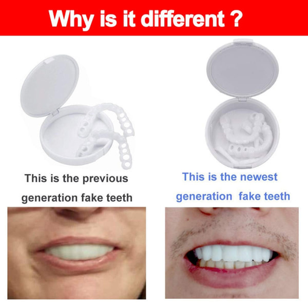 Falske tænder, øvre og nedre tandproteser, Snap On V - Perfet