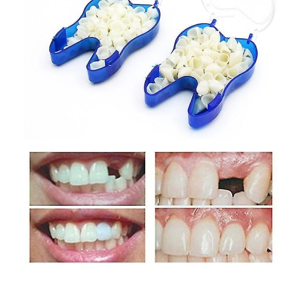 Temporary proteser blockerar övre proteser, fasader, saknade tänder, trasiga tänder och mellanrum mellan tänderna - Perfet