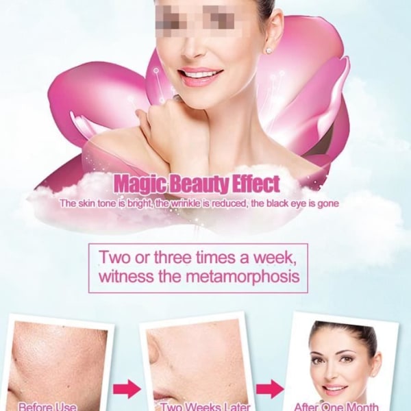 BEL-7293629057378-Rynkelborttagningsmaskin Ultrasonic Skin Rejuvenation Anti-aging Beauty Device för