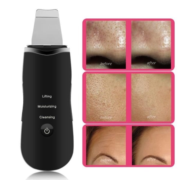 Skin Scrubber, Ultrasonic Ion Facial Pore Cleaner, Cuticle Remover, Cuticle Borttagning,