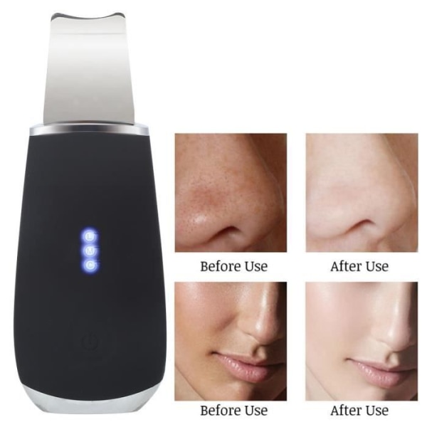 HURRISE Facial Skin Scrubber Ultrasonic Skin Scrubber Cleaner Blackhead Acne Borttagningsinstrument