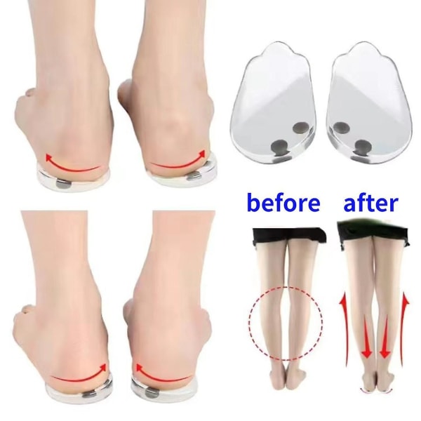 1 pari Flatfoot Orthotics -pohjallinen kahdeksan varpaan sisällä Foot Orthotic Varus Correct Shoes -sisäpohja