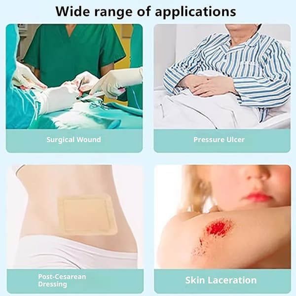 1 st silikonskumförband med självhäftande kant, vattentätt E