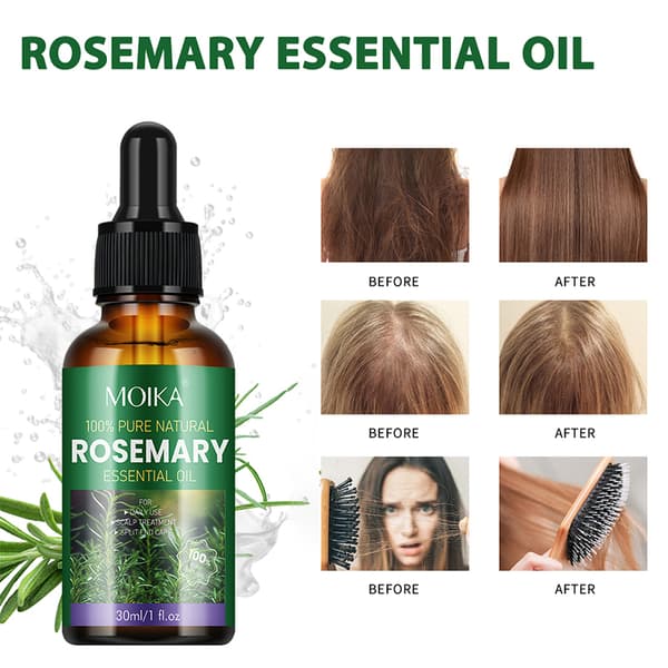 MOIKA Rosmarin Hårolja Förhindrar Håravfall Behandling D 30ml