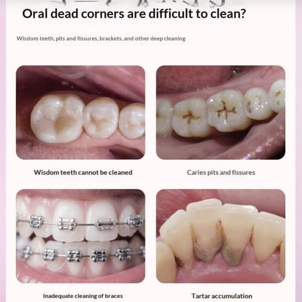 Interdentalbørster med lite hode for rengjøring av ortodontisk interdental