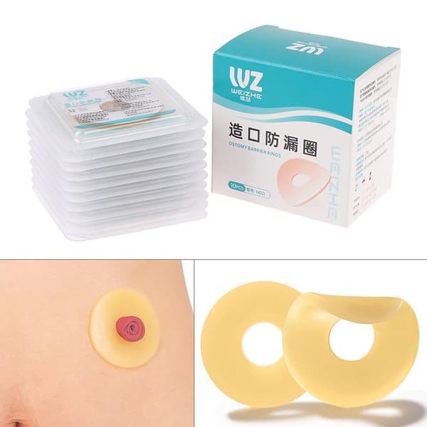 10 stk. anti-lekkasjering for kolostomipose stomipasta ringbase