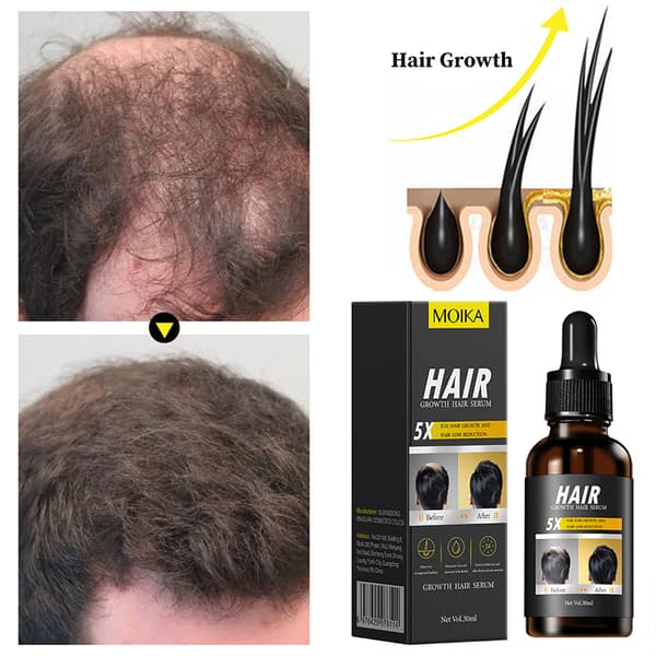 MOIKA Hårvekstserum Reparerende Eterisk Olje Styrker Hårroten 30ml