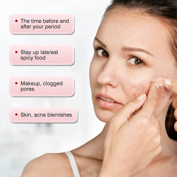 MOIKA Bumsplaster Akne Usynlig Aknefjernelse Concealer Ansigt S 36pcs