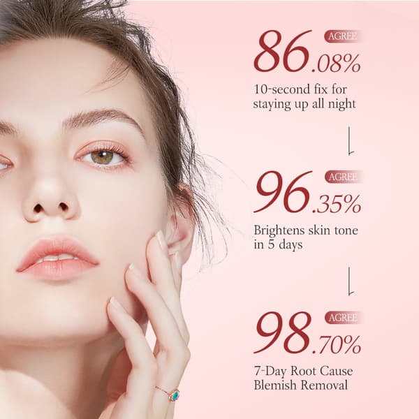 MOIKA Niacinamide 10%+TXA 4% Dark Spot Correcting Serum 30ml Br 30ml