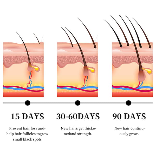 MOIKA Hårväxtserum Reparerande Eterisk Olja Stärker Hårroten 30ml