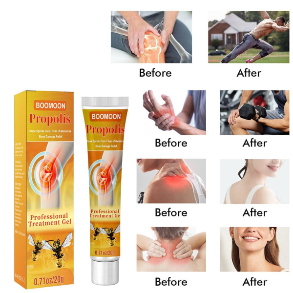 1-5X Beevenom New Zealand Bee Professional Treatment Gel Natural 20gA 1pcs 5pcs