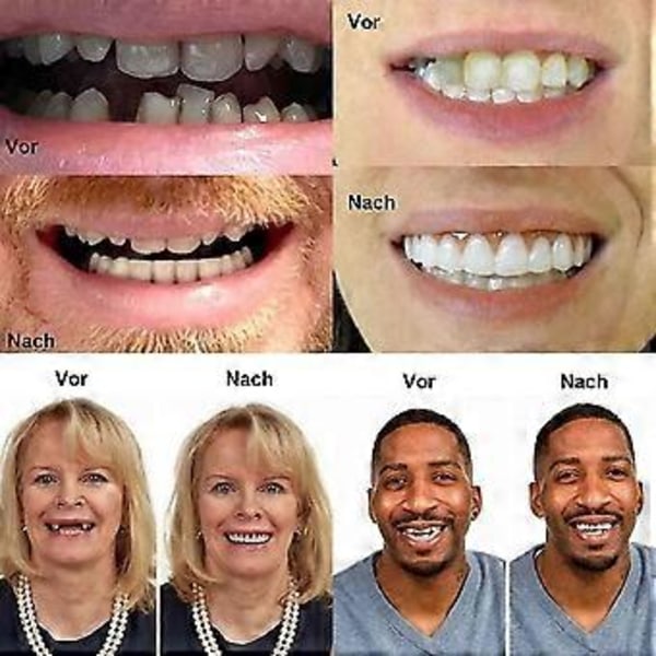 Midlertidige proteser Hurtig tandprotese Top Perfekt Smil Facader, Reparer din tand hurtigt, Få dig til at smile selvsikkert
