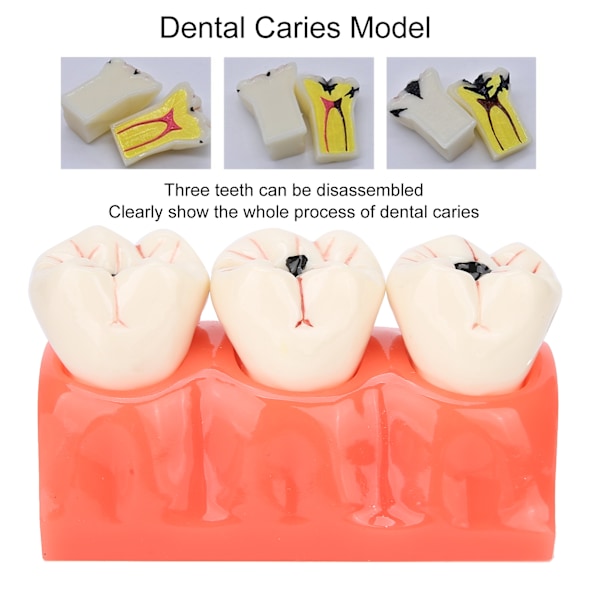Högt Simulerad Dental Undervisningshjälp, Syntetisk Hartstandmodell För Professionell Träning Och Utbildning, Tydlig Morfologisk Struktur, Vuxen