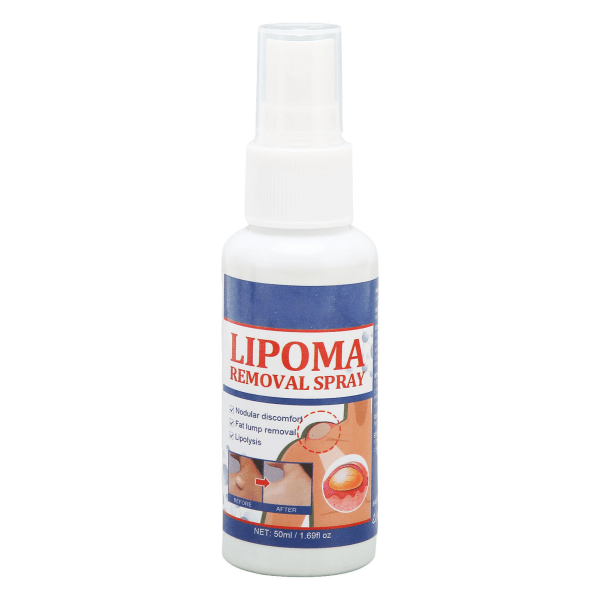 50 ml spray för borttagning av lipom, spray för borttagning av subkutana fettknölar för eliminering av fettblockering