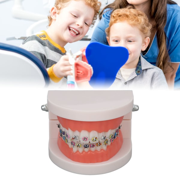 Professionell ortodontisk metallbracket för dental forskningsmodell, avtagbar design förbättrar utbildningsupplevelser, lätt och hållbar för skolan
