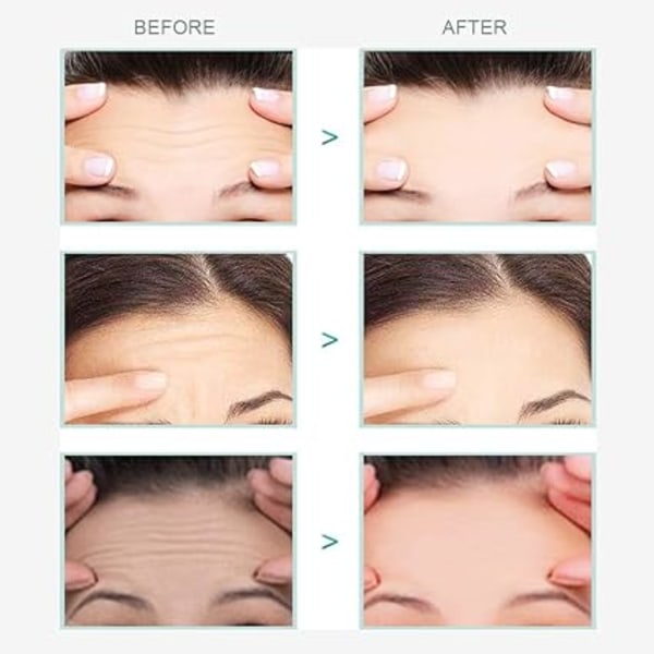 Facial Patches, Anti Wrinkle Patch, Anti Wrinkle Forehead, Anti Wrinkle Patches for Face, Anti Wrinkle Face Patch, Anti Wrinkle Forehead Patch, 20 Pcs