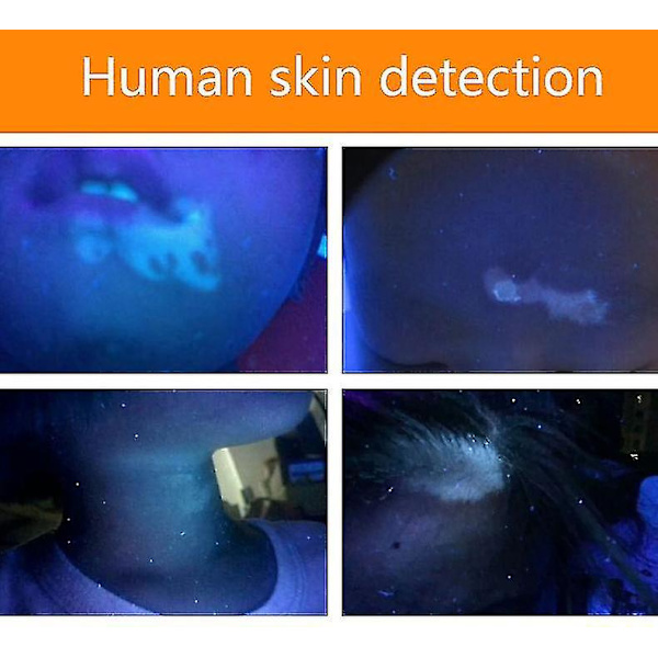 Lätt handhållen Woods lampa våglängd ultraviolett diagnostisk uv hud svampdetekteringsanalysator + ficklampa funktion