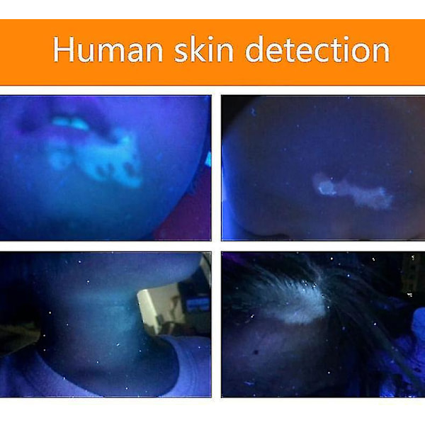 Lett håndholdt Woods lampe bølgelengde ultrafiolett diagnostisk UV hud soppdeteksjonsanalysator + lommelyktfunksjon