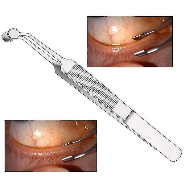 Meibomian Gland Massage Tweezers Ophthalmological Fat Eye Physiotherapy Device Eye Apparatu Medical Surgery