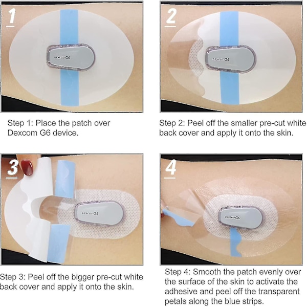 10 st Dexcom G6 Självhäftande Plåster, Vattentäta Plåster För Dexcom G6, Premium Transparent Överplåster För G6 Sensor (10 st, bl