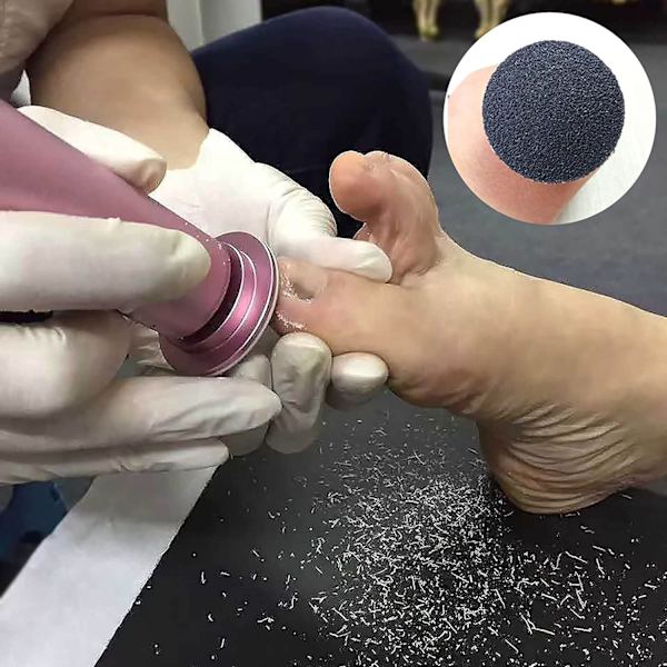 Slibeskive Pedicure Fodfil Sandpapir Hård hudfjerner