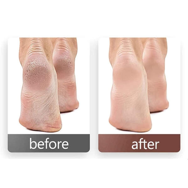 Sandpapir Disker Callus Remover Pedikyrverktøy