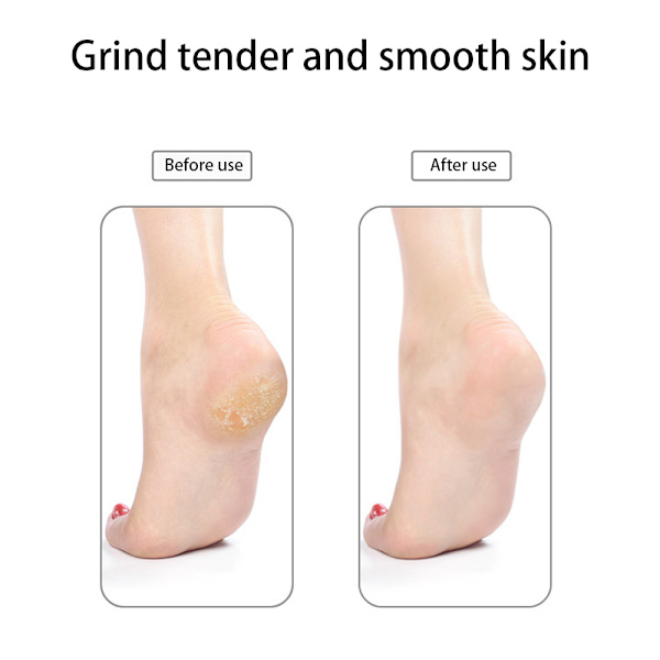 Fodfil Hård hudfjerner Pedicure Sæt til Fødder, Pimpsten til Fødder