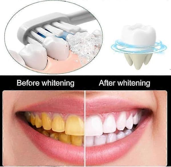 Sp-10 Whitening Toothpaste, SP 10 Whitening, Sp-10 Probiotics Whitening Toothpaste, SP-10 Toothpaste, Sp-10