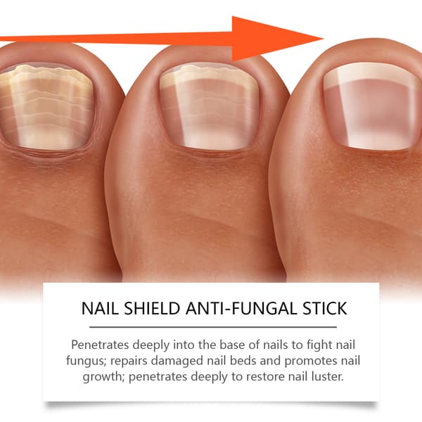 10ml/æske AMZ Clean & Protect Neglerulle